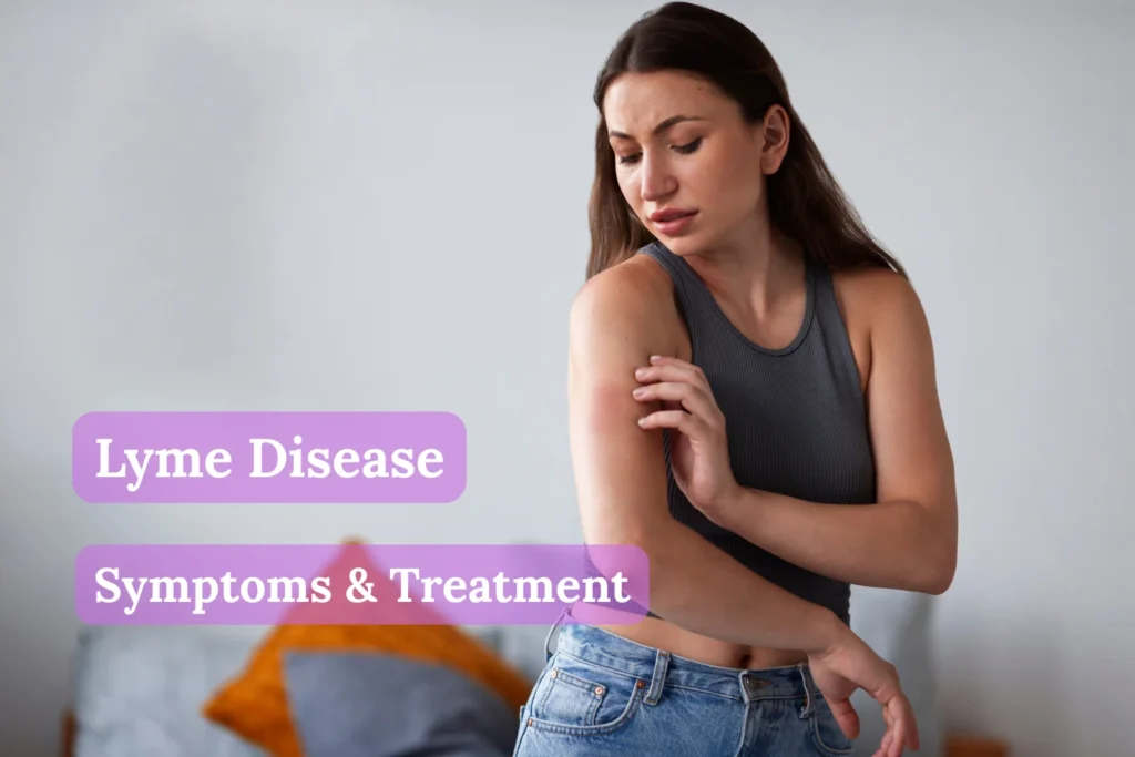 Lyme Disease